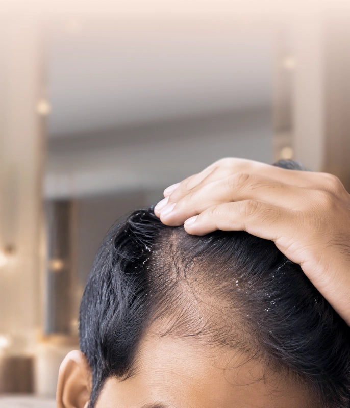 Hairfall & Dandruff